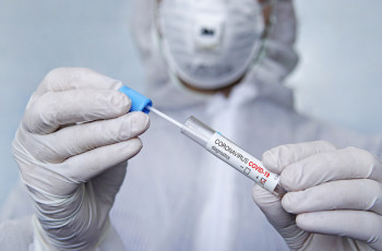 Wykonaj test na obecność wirusa SARS-CoV-2 metodą real time PCR – szybko, bezpiecznie  i wygodnie - bez skierowania od lekarza ubezpieczenia zdrowotnego