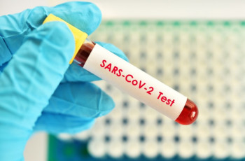 Ilościowe oznaczenie anty-SARS-CoV-2 IgG w IPCZD
