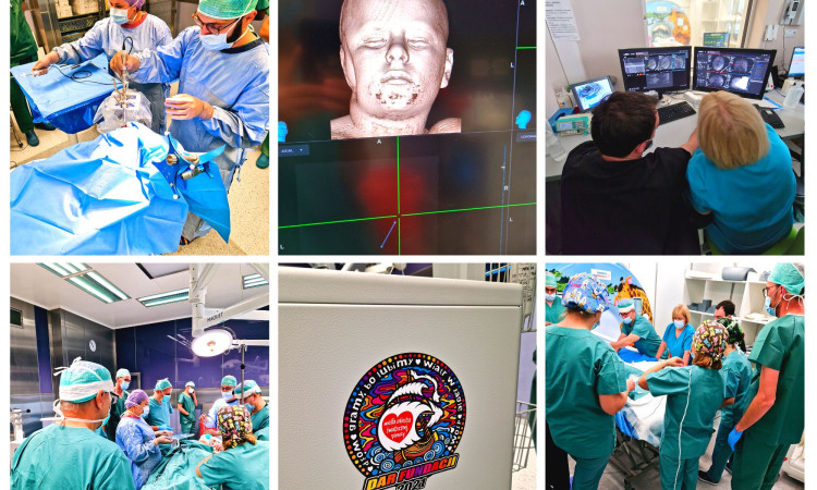 Pierwsza w Polsce Laserowa Termoablacja głęboko położonego guza mózgu u dziecka